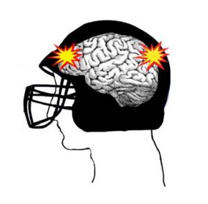 concussion head